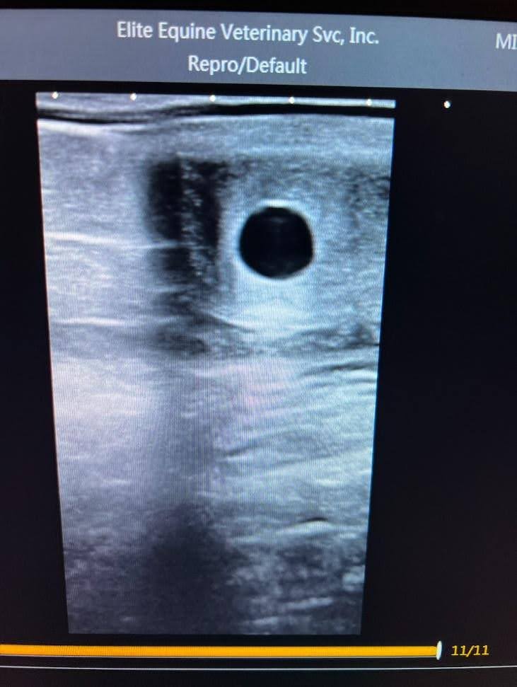 This is a screenshot of Annie’s 14-day old embryo.